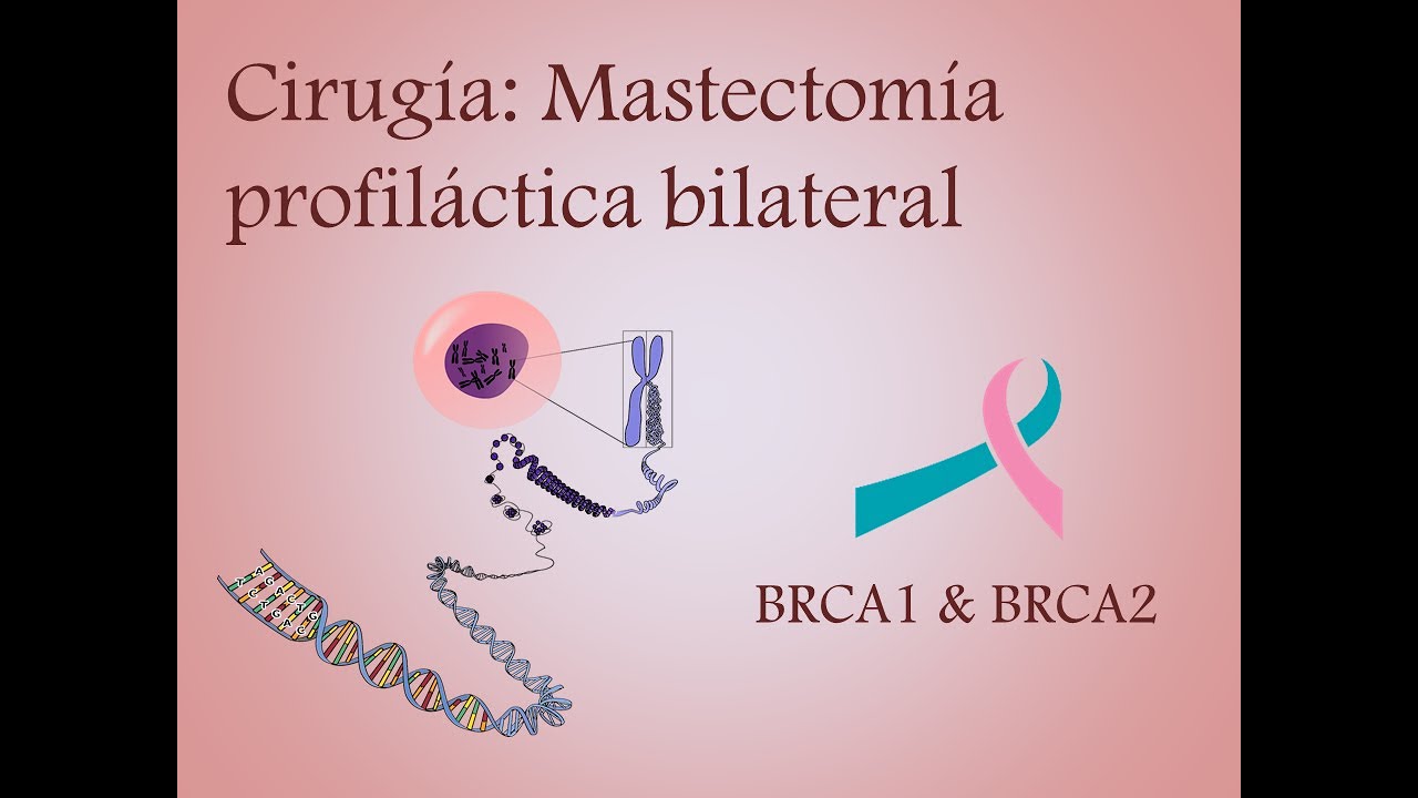 mastectomía bilateral preventiva con reconstrucción inmediata