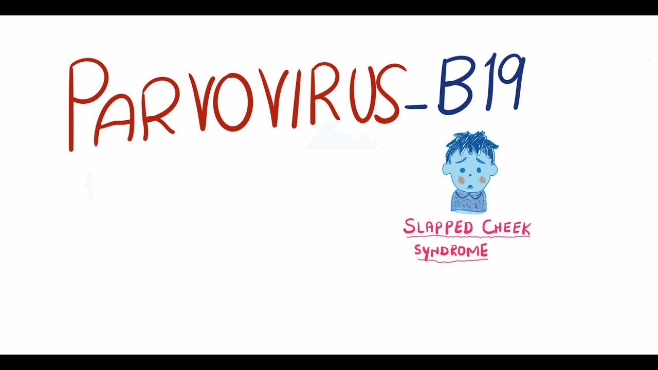 parvovirus b19 igg positivo e igm negativo