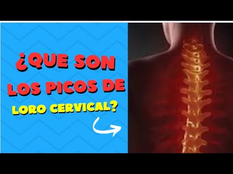 picos de loro en las cervicales