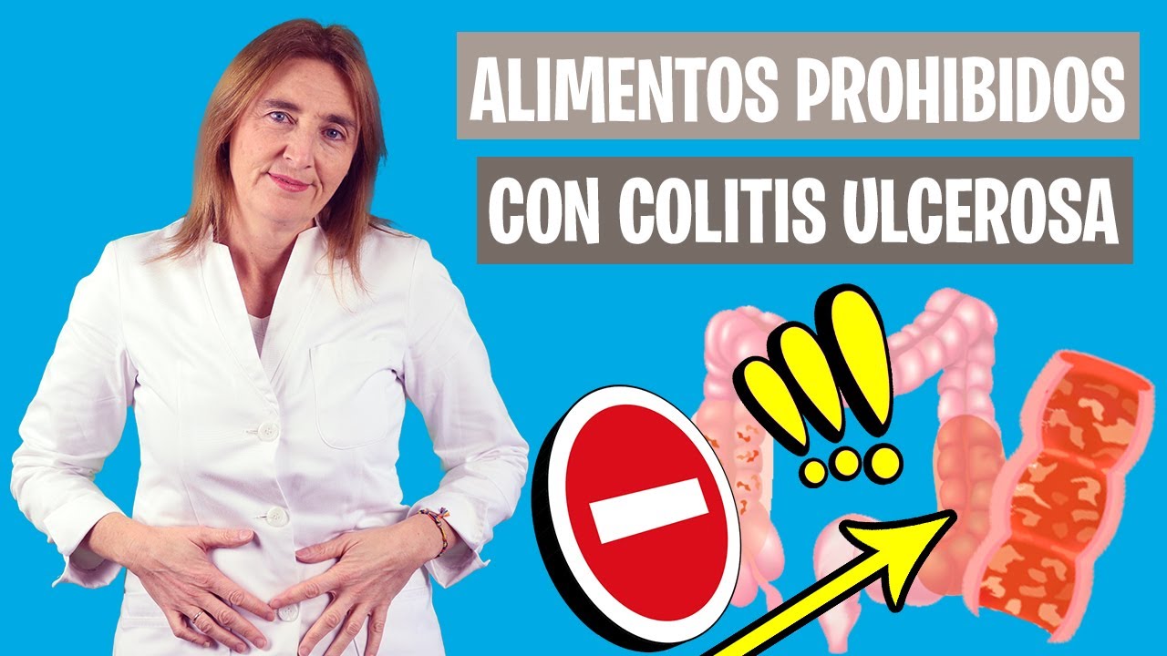 que comer con brote de colitis ulcerosa
