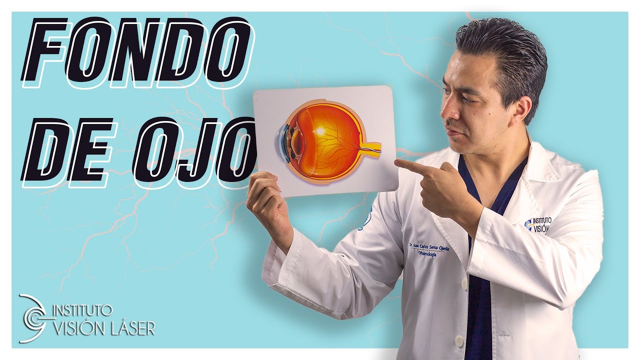 que es un fondo de ojos