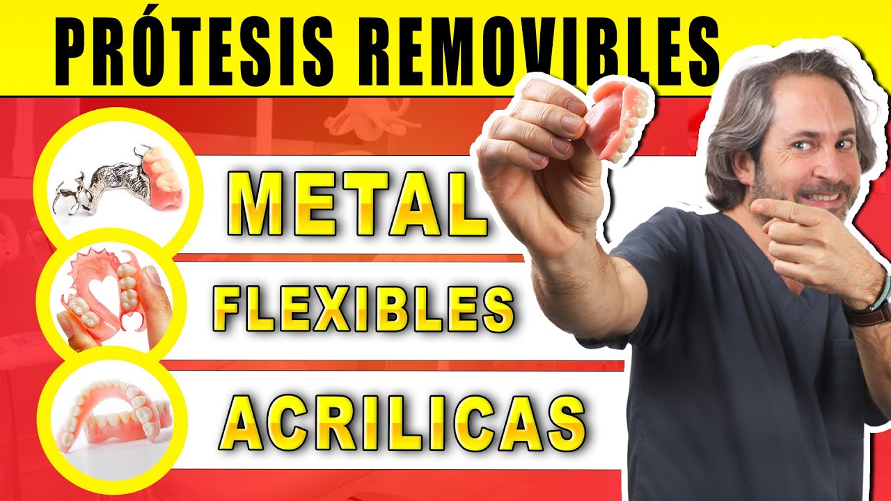 que material es mejor para una prótesis dental
