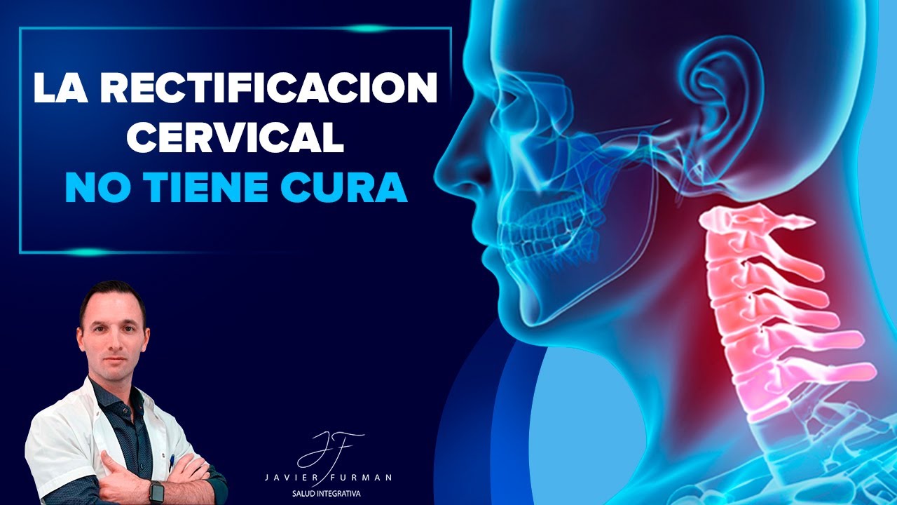 rectificación de la lordosis cervical tratamiento