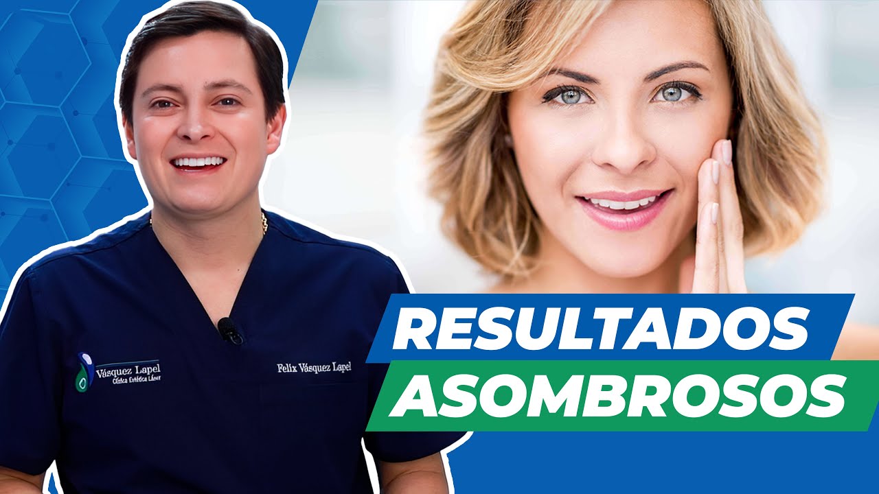 rejuvenecimiento facial con láser antes y después