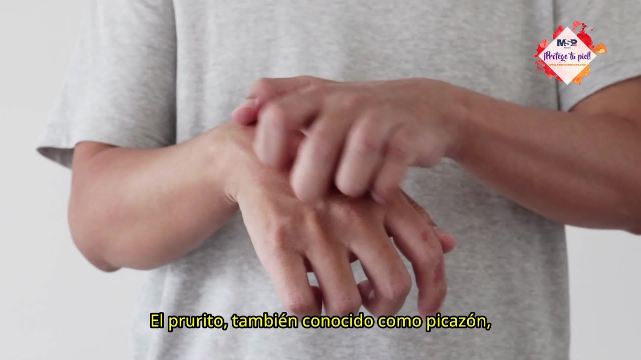 sensacion de picor en la piel