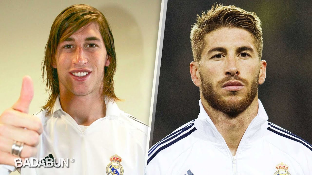 sergio ramos antes y despues cirugia