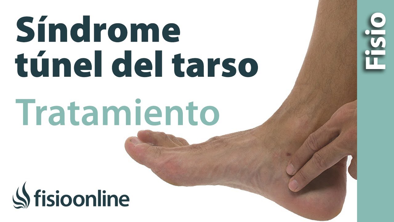 tiempo de recuperación después de operación túnel tarsiano