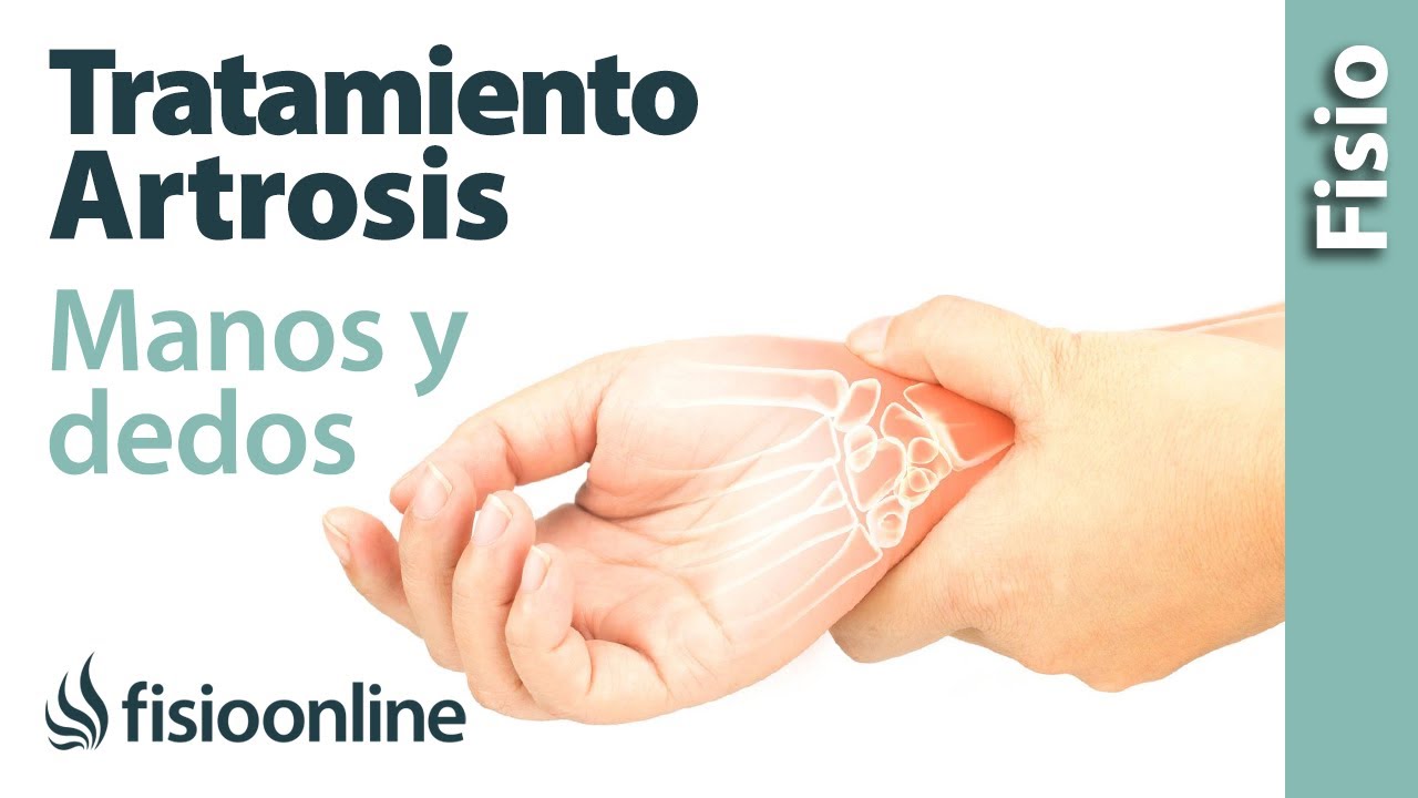 tratamiento para la artrosis de manos