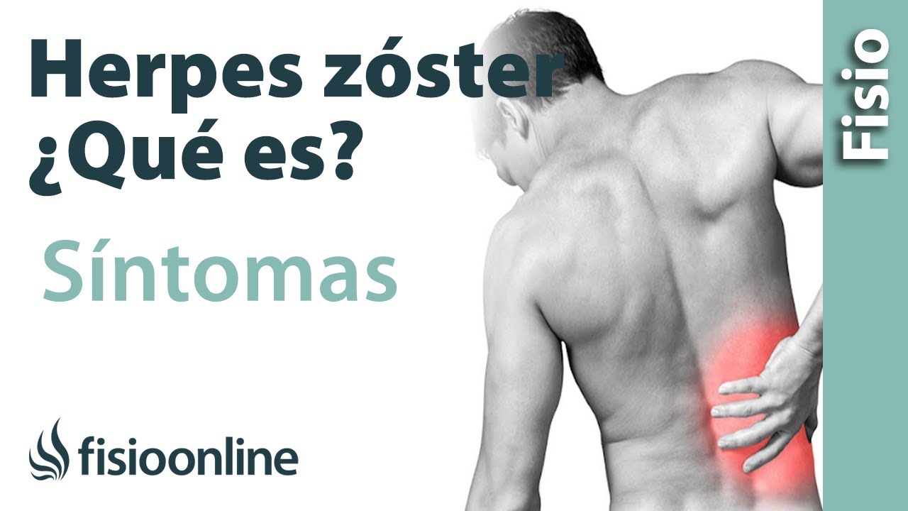varicela zoster igg positivo que significa