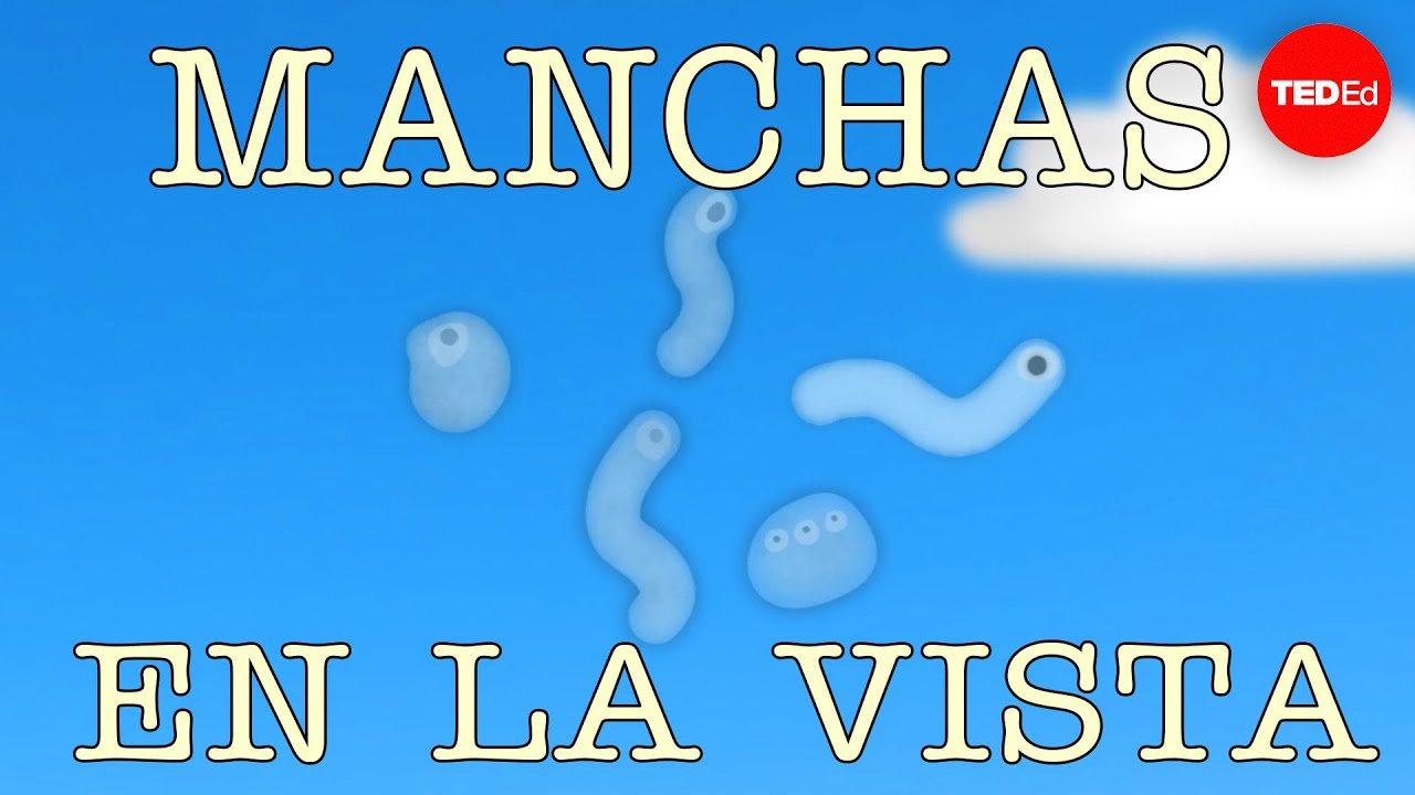 ver manchas amarillas en la vista